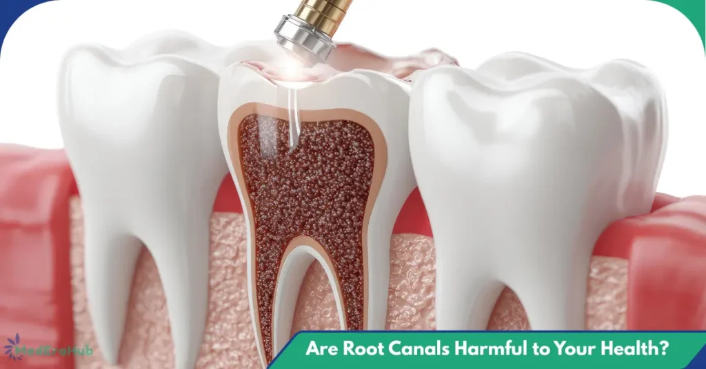 are root canals harmful to your health