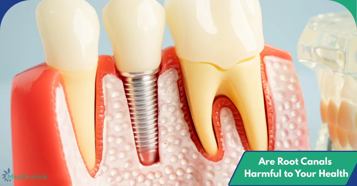 Are Root Canals Harmful to Your Health