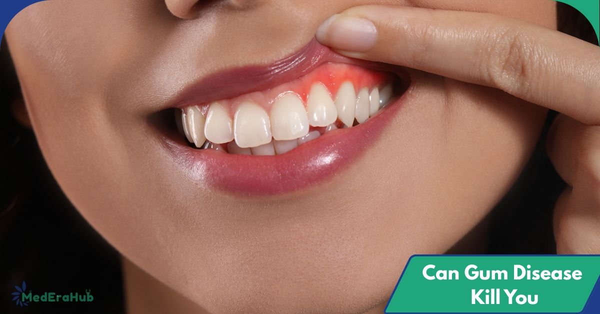 Can Gum Disease Kill You