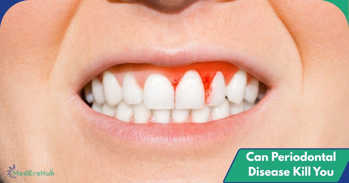 Can Periodontal Disease Kill You
