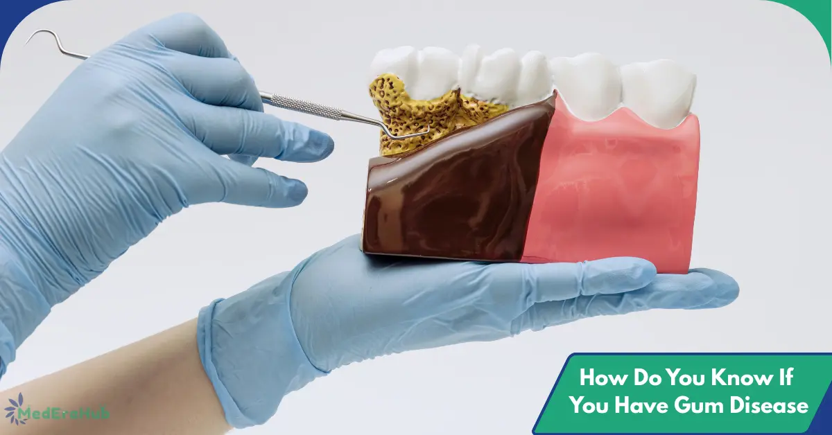 How Do You Know If You Have Gum Disease?