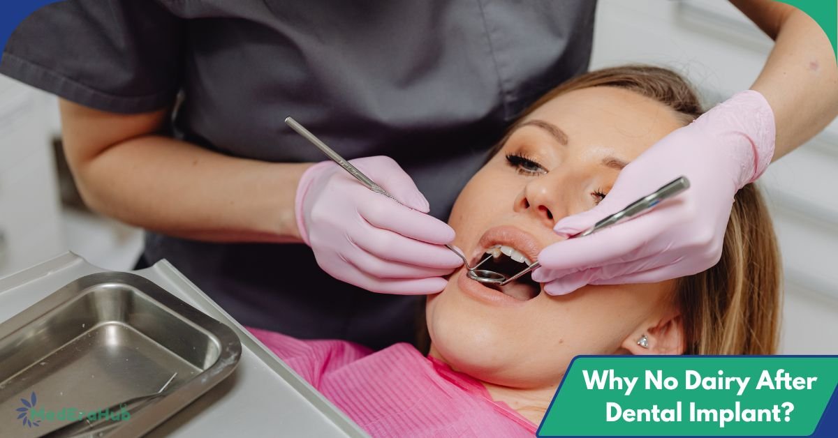Why No Dairy After Dental Implant