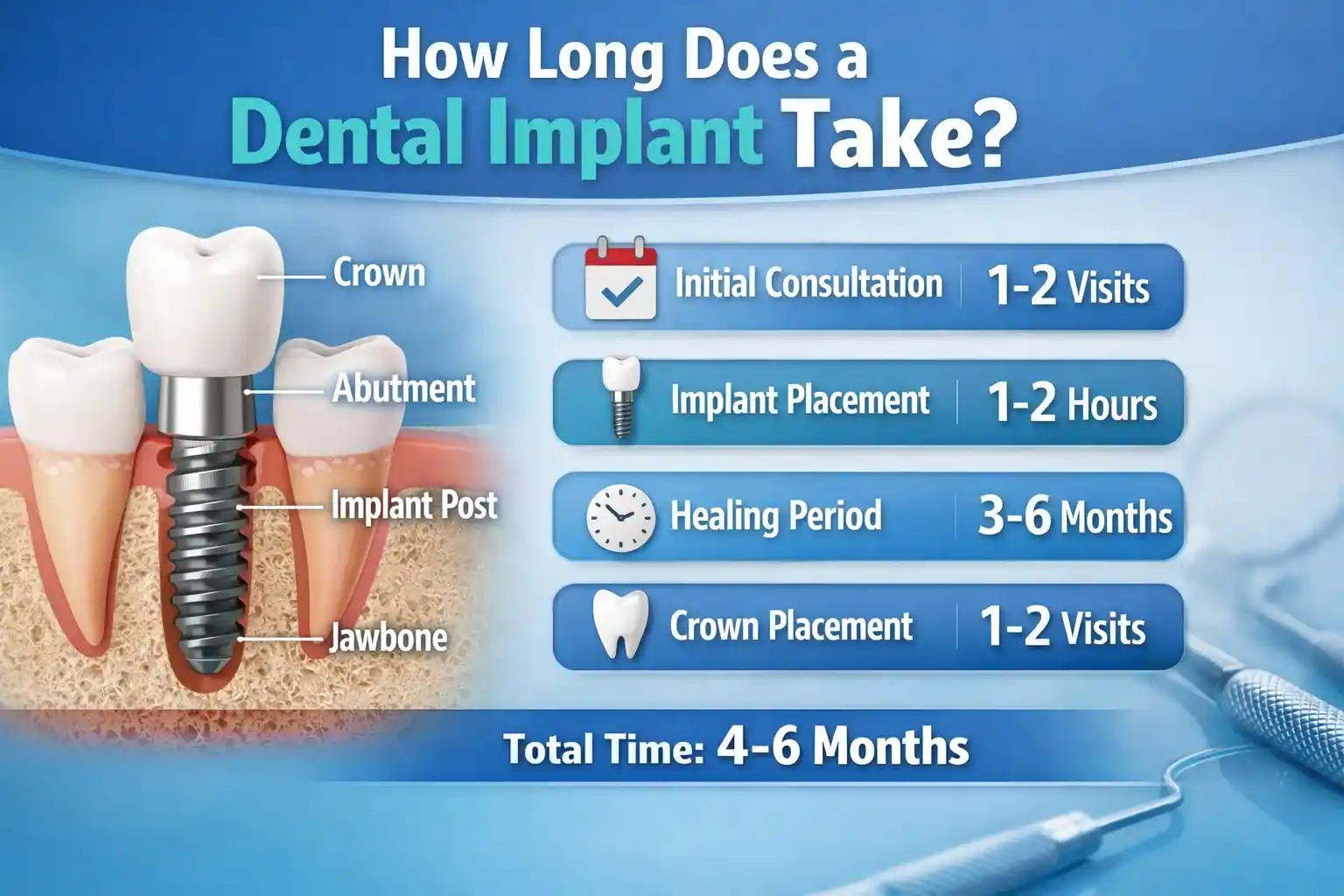 How Long Does a Dental Implant Take?