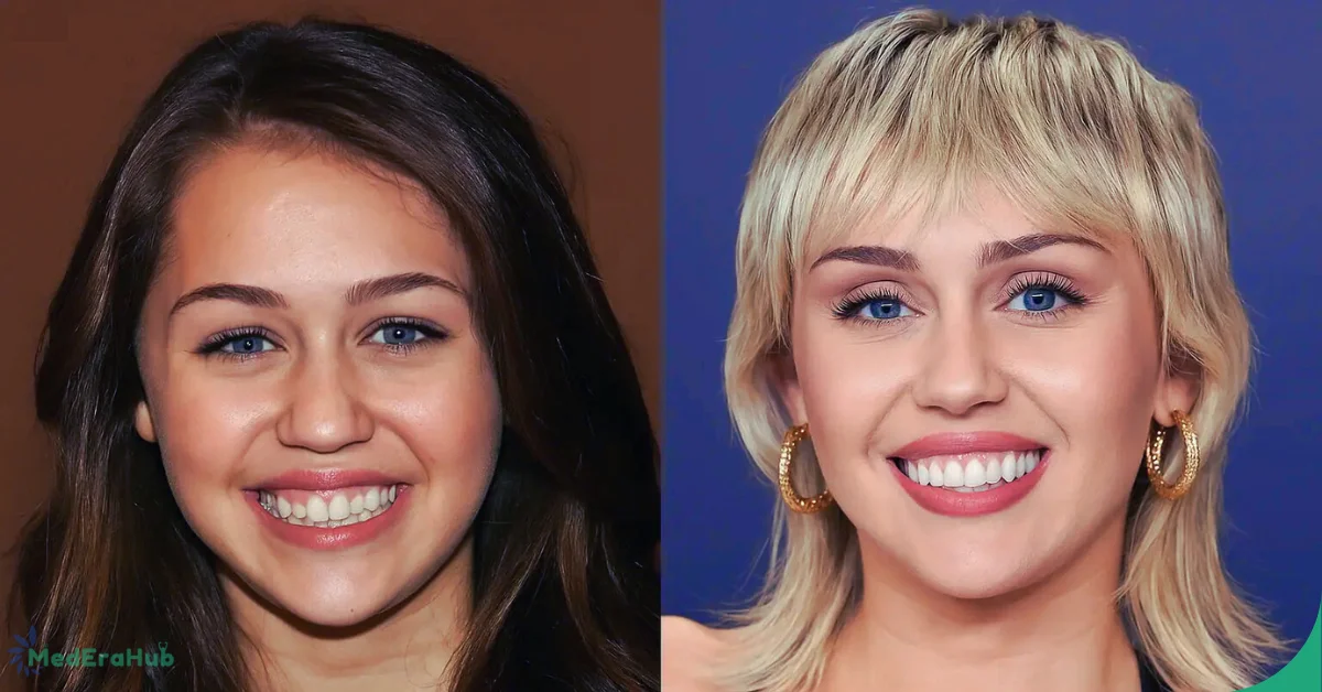 Miley Cyrus Before and After Teeth